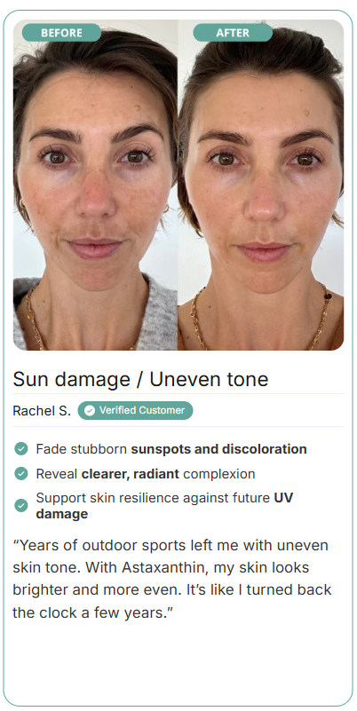 FEMMA Astaxanthin Soft Gel