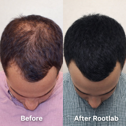 Give Your Hair a Fuller, Healthier Look with ROOTLAB