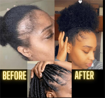 Femma Hair Growth Oil