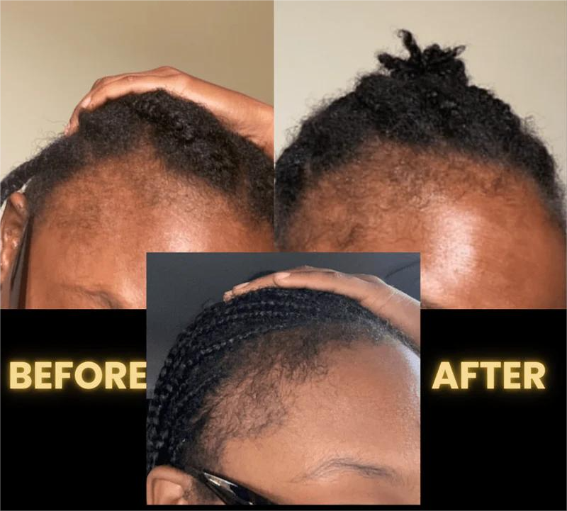 Femma Hair Growth Oil