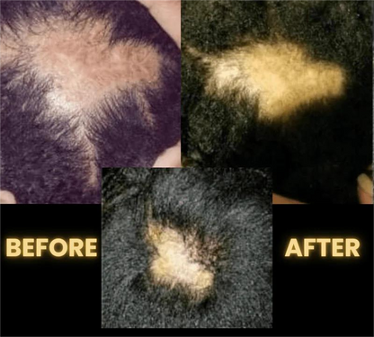 Femma Hair Growth Oil