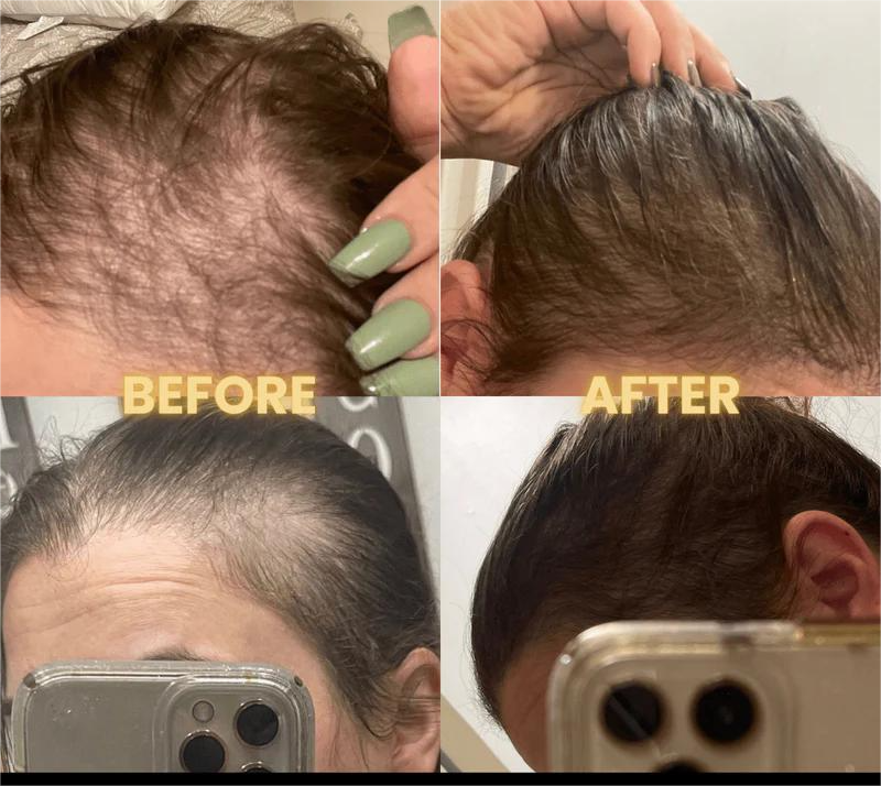 Femma Hair Growth Oil