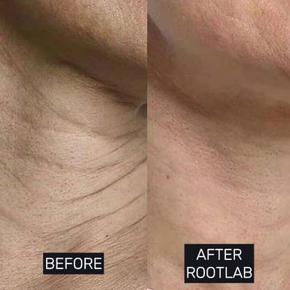 Skin Care Collagen Polypeptide Microneedle Suit